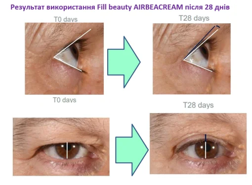 Лифтинг крем для кожи вокруг глаз Bijou de Mer Fill Beaute Eye Lever Cream, 50 мл